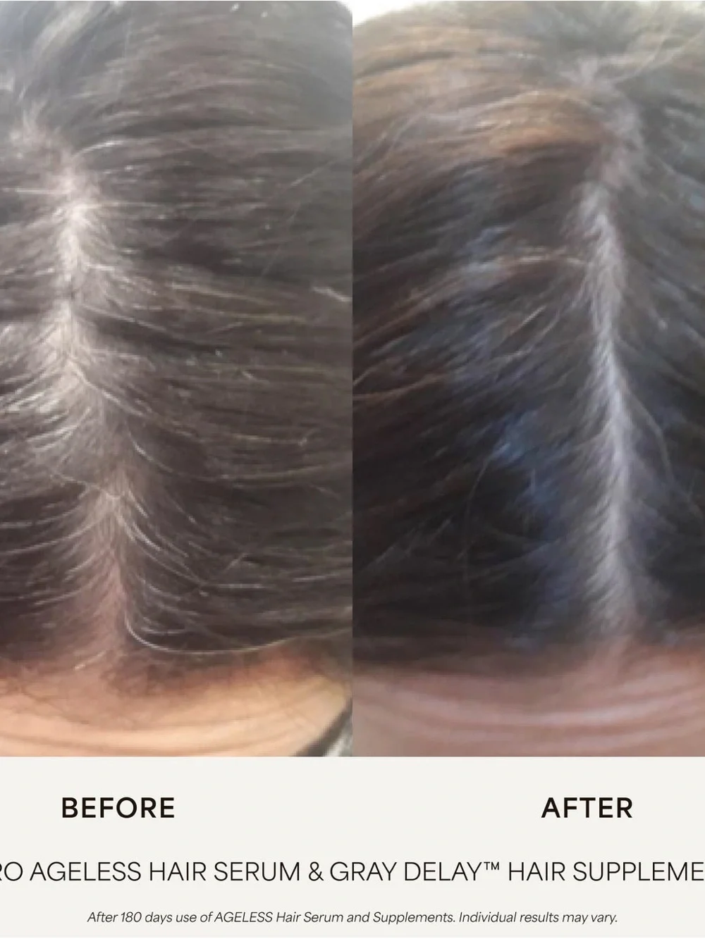 VEGEMOUR GRO AGELESS Anti-Gray Hair Serum • FULL SIZE SEALED 1 Oz. Bottle NEW!